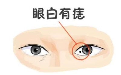 眼白有痣的男人非常好色？