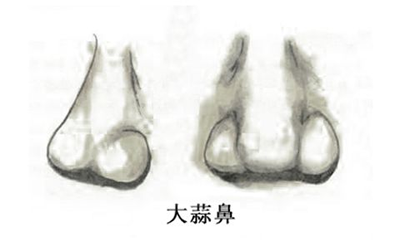 長蒜頭鼻是不是好命？