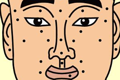 男人財帛宮有痣有何含義
