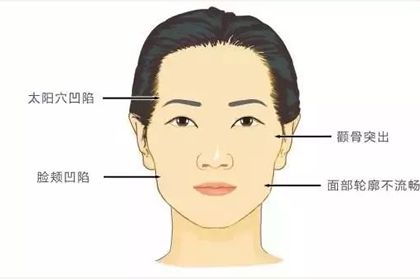 額頭不飽滿的女人財運比較弱嗎
