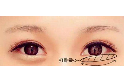 解析圓眼和臥蠶眼這兩種眼型