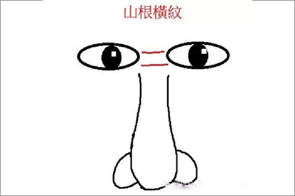 鼻樑有橫紋是好還是不好