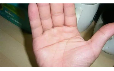 女人假斷掌要怎麼去判斷呢?