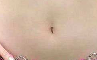 海蛇形的肚臍一生命運如何？