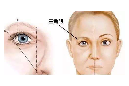 解析三角眼男人性格小心多疑出暴力