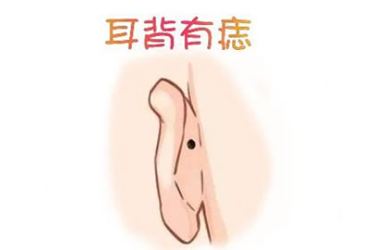 耳朵背後長痣代表著什麼