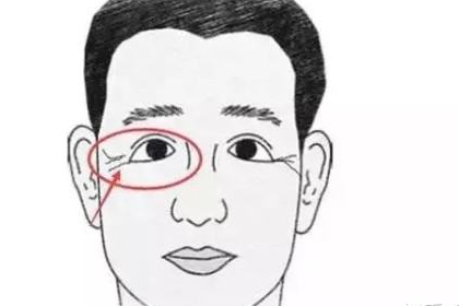 幾種最常見的糟糕面相