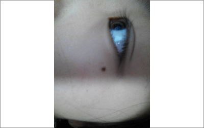 分析臉上有淚痣的女孩如何?