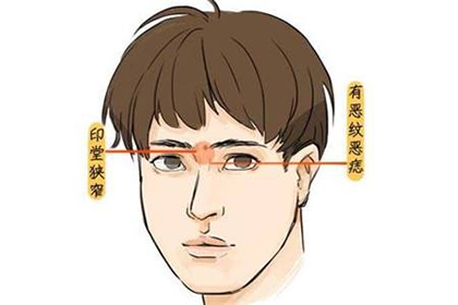 如何辨別印堂面相的好壞