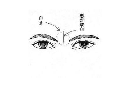 大師揭祕斬子紋面相是什麼