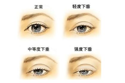 下垂眼的女人桃花運好不好