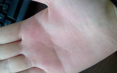 關於男人假斷掌是怎麼一回事