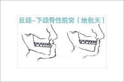 男人地包天窮人面相果真如此