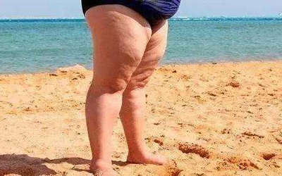 擁有肚包腿的男人婚姻如何？