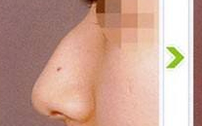 駝峰鼻的人命運是不是很坎坷?