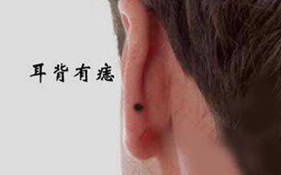 耳朵背後長痣面相圖解