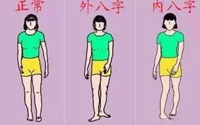 擁有外八腿的男人一生孤獨？