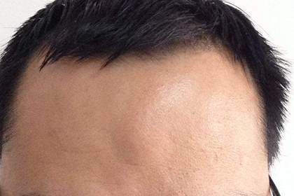 額頭明亮的人最忌諱做什麼事情呢