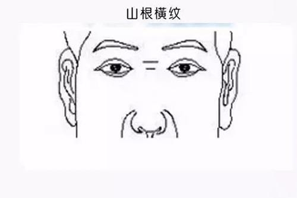 鼻樑有橫紋是好還是不好