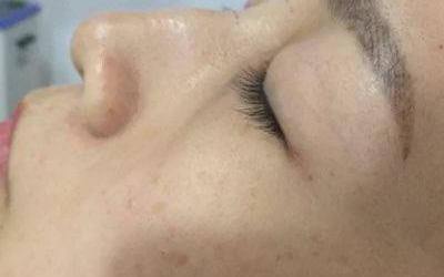 駝峰鼻面相的人桃花運情況