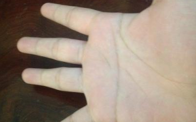 關於感智分叉假斷掌是怎麼樣的呢？