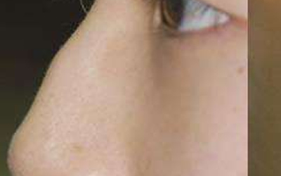 駝峰鼻面相的人桃花運情況