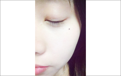 分析臉上有淚痣的女孩如何？