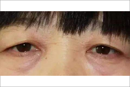 揭祕性格懦弱的人面相