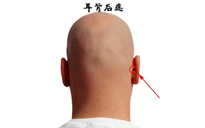 耳朵背後長痣面相圖解