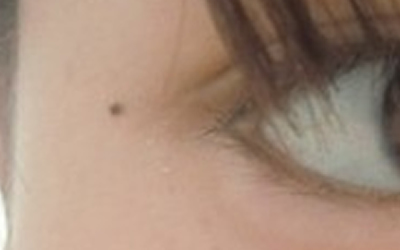 右眼有淚痣的女孩如何?