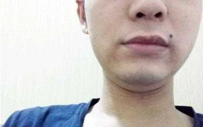 男人臉上哪裡長痣可以招來桃花？