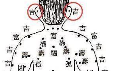 男人事業糟糕跟這顆惡痣有關係