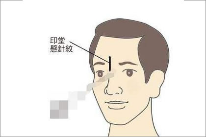 懸針紋會給一個帶來什麼影響呢？