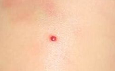 分享一下胸前有硃砂痣的具體含義