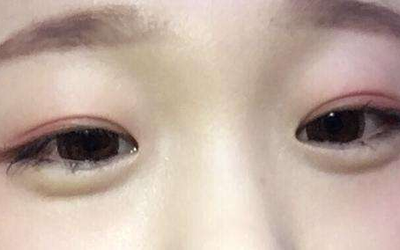 愛別離求不得，說的就是這五種面相的一生！