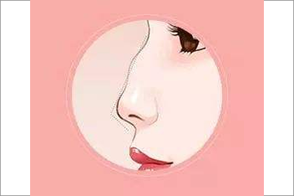 駝峰鼻型的女人命運如何