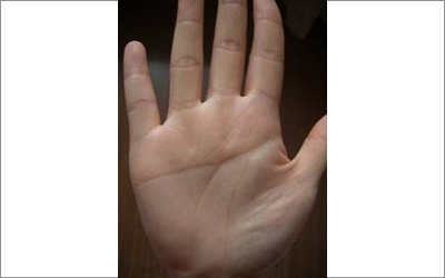 關於男人假斷掌是怎麼一回事