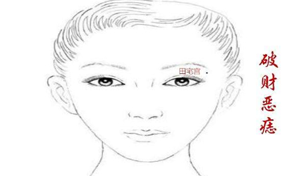 男人會克妻跟這顆惡痣有關係