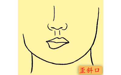 嘴巴歪斜的女人會有福運嗎?