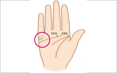 婚姻線末尾下垂代表什麼