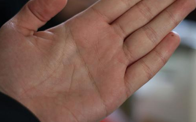 關於感智分叉假斷掌是怎麼樣的呢？