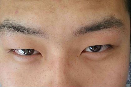 眼睛細長的人晚年身體健康嗎