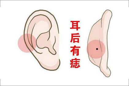 耳朵背後長痣代表著什麼